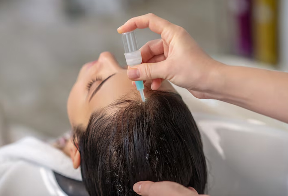 Specialized hair loss treatment for alopecia and pattern baldness in Kerala